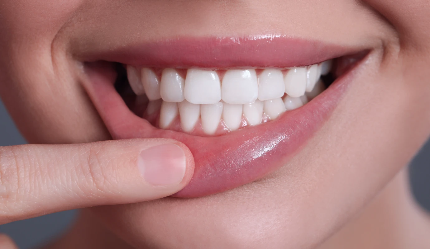 Les maladies parodontales et leur prévention au cabinet B, parodontie exclusive à Nice